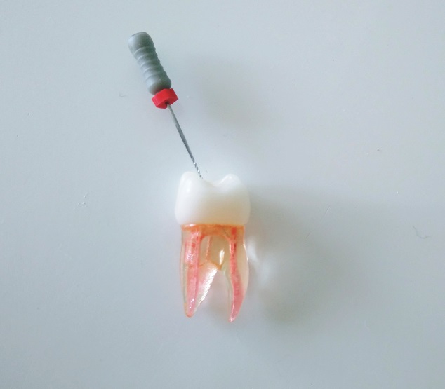 Image of a model tooth being drilled during endodontic treatment.