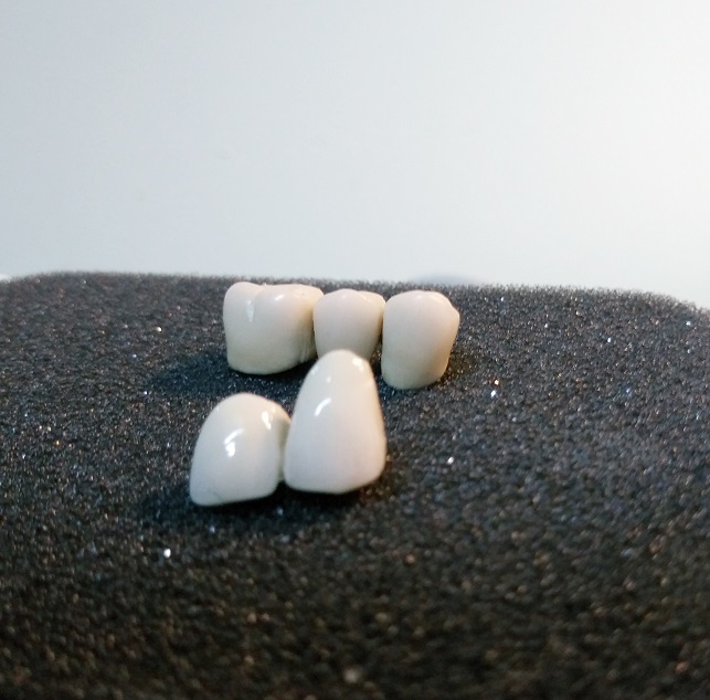 Image showing fixed dental prosthetics.