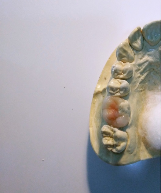 Image of model of a set of teeth.